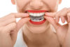 Invisalign for dental practices